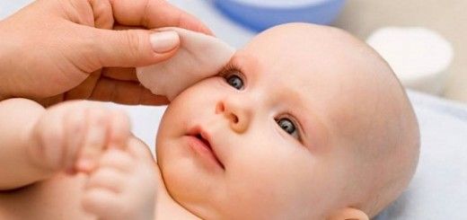 Bebeklerde Göz Çapaklanması
