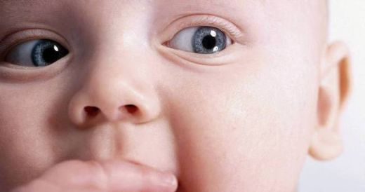 Bebeklerde Göz Kayması