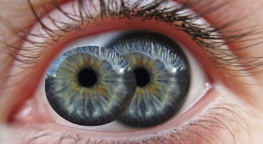 Göz Bebeği Hastalıkları Belirtileri ve Tedavisi